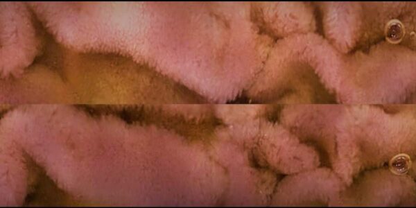 Kapsül endoskopi resmi